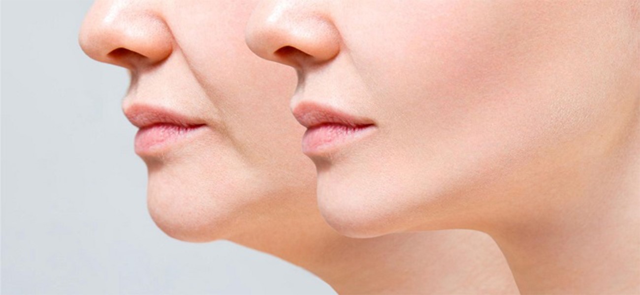 مراقبتهای بعد از ساکشن غبغب