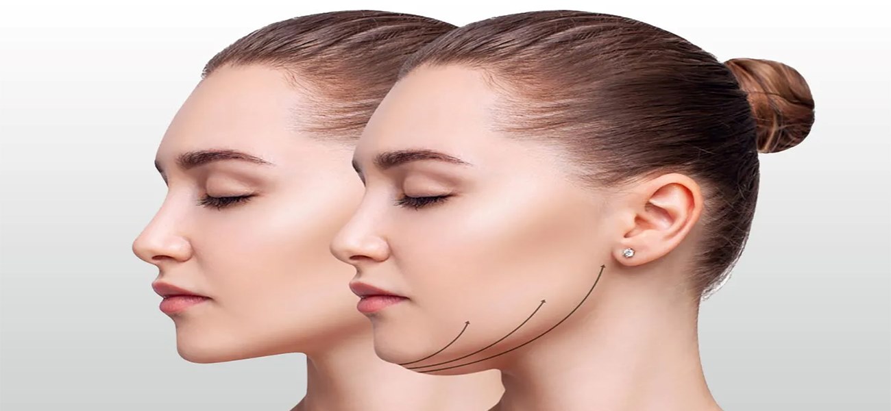 عوارض احتمالی ساکشن غبغب