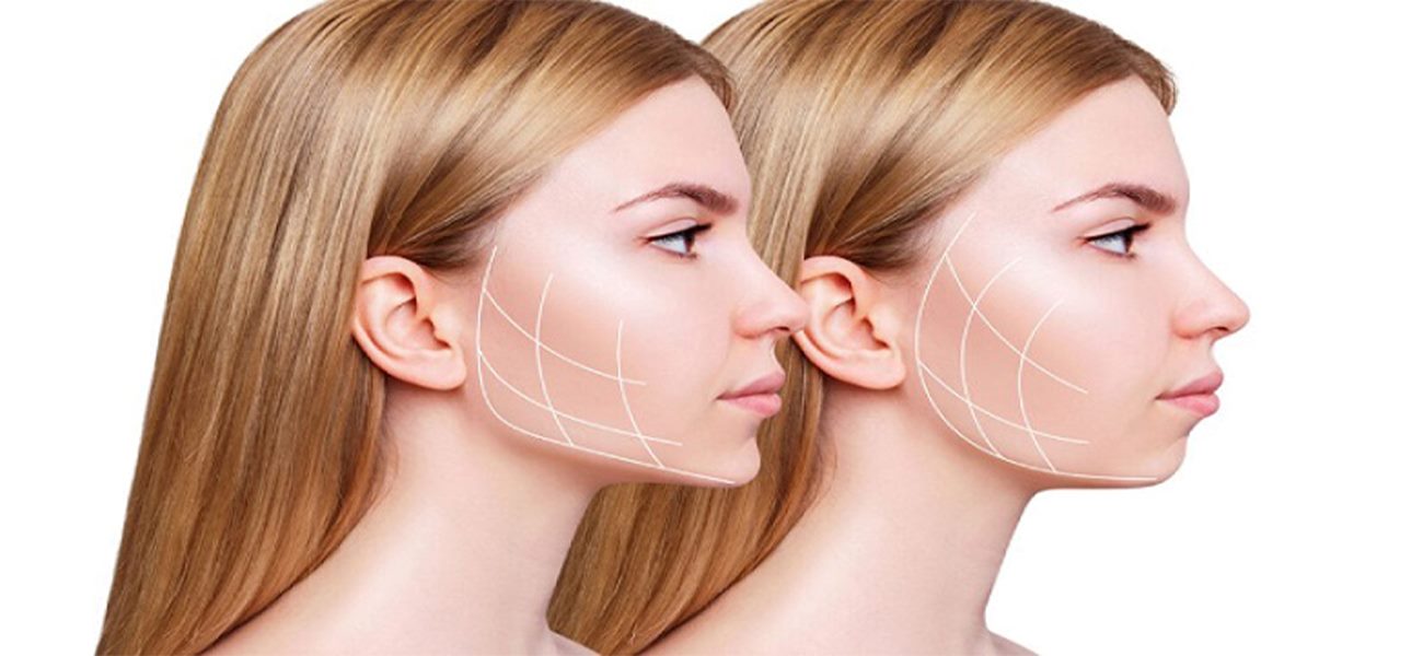 رفع غبغب بدون جراحی