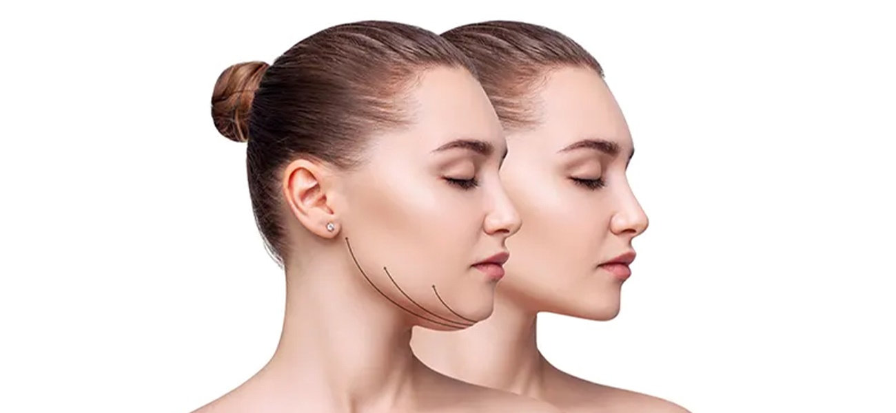 آیا ساکشن غبغب بیهوشی دارد ؟