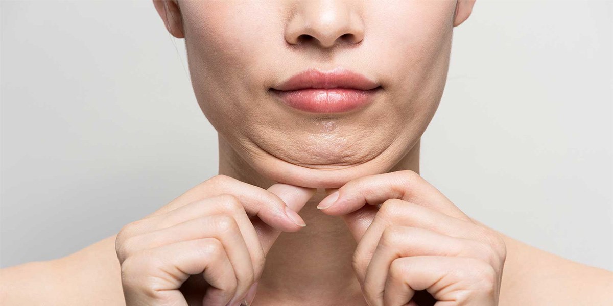 کج شدن لب بعد از ساکشن غبغب